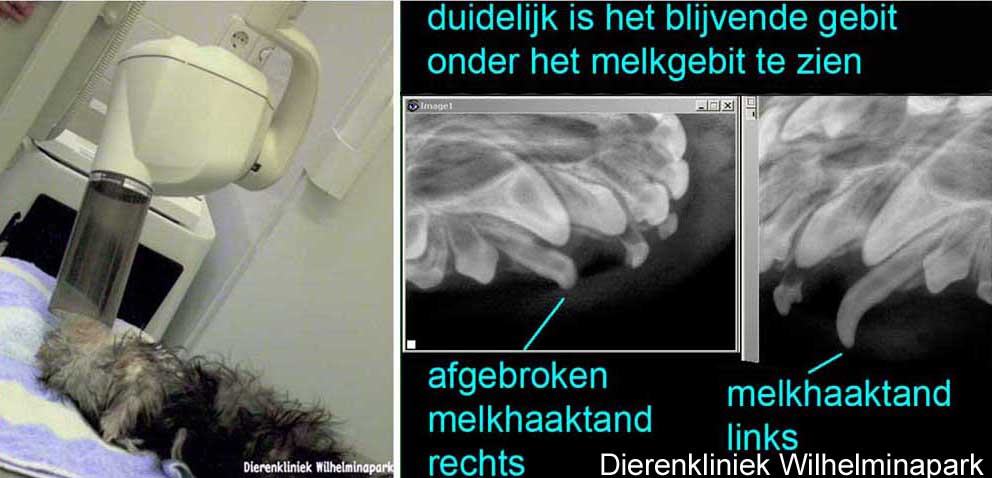 Op de rontgenfoto is goed te zien dat het volwassen gebit al aangelegd is